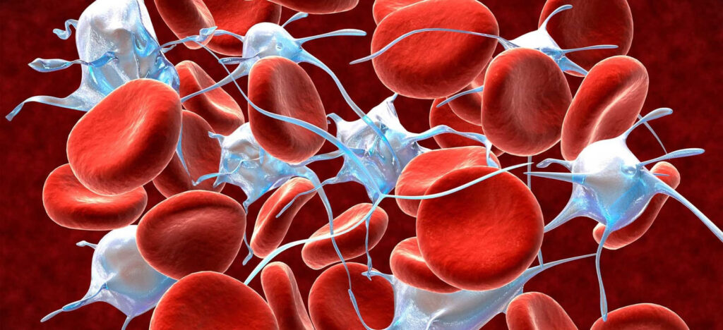 Disorders of blood