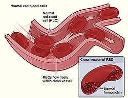 Hereditary and Acquired Anemia
