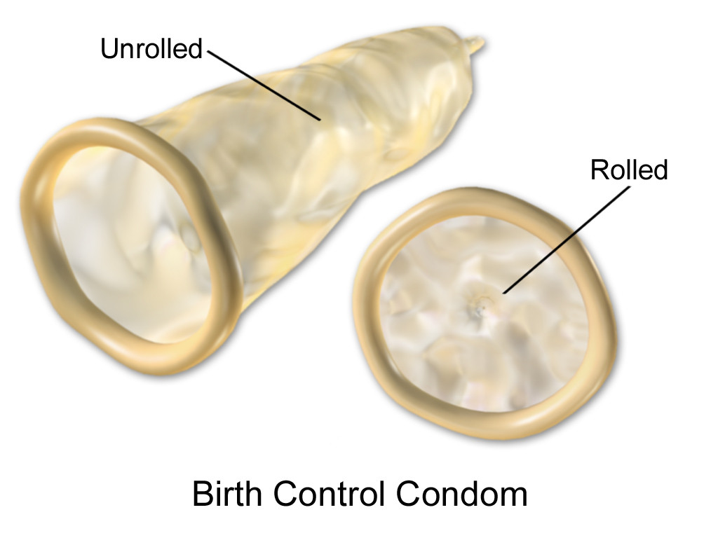 image 3 7 Contraceptive Devices