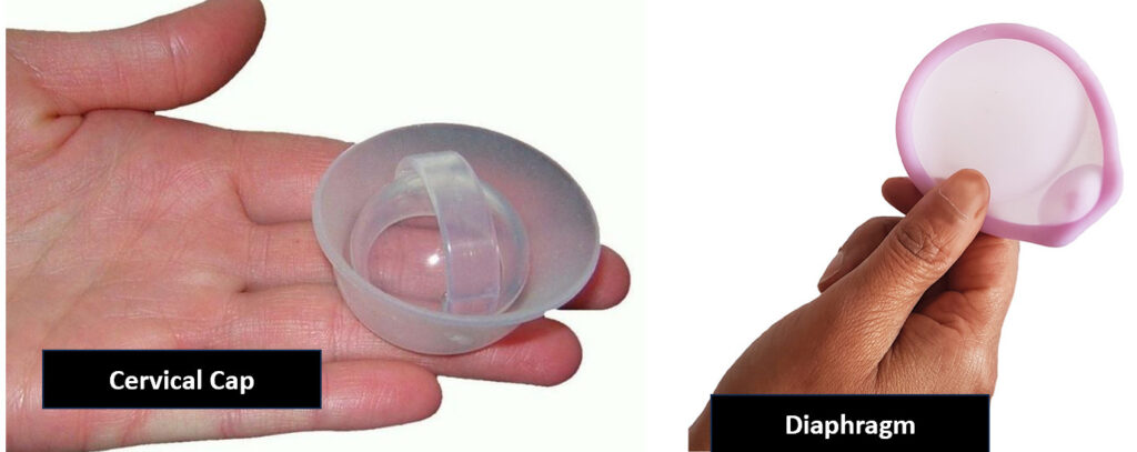 image 4 4 Contraceptive Devices