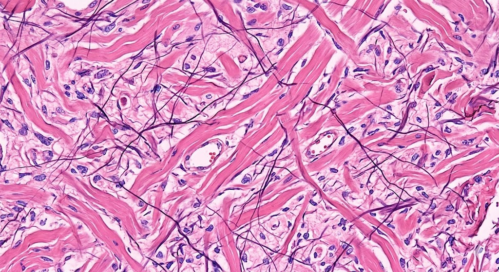 Connective tissue