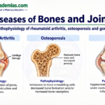 Diseases of Bones and Joints