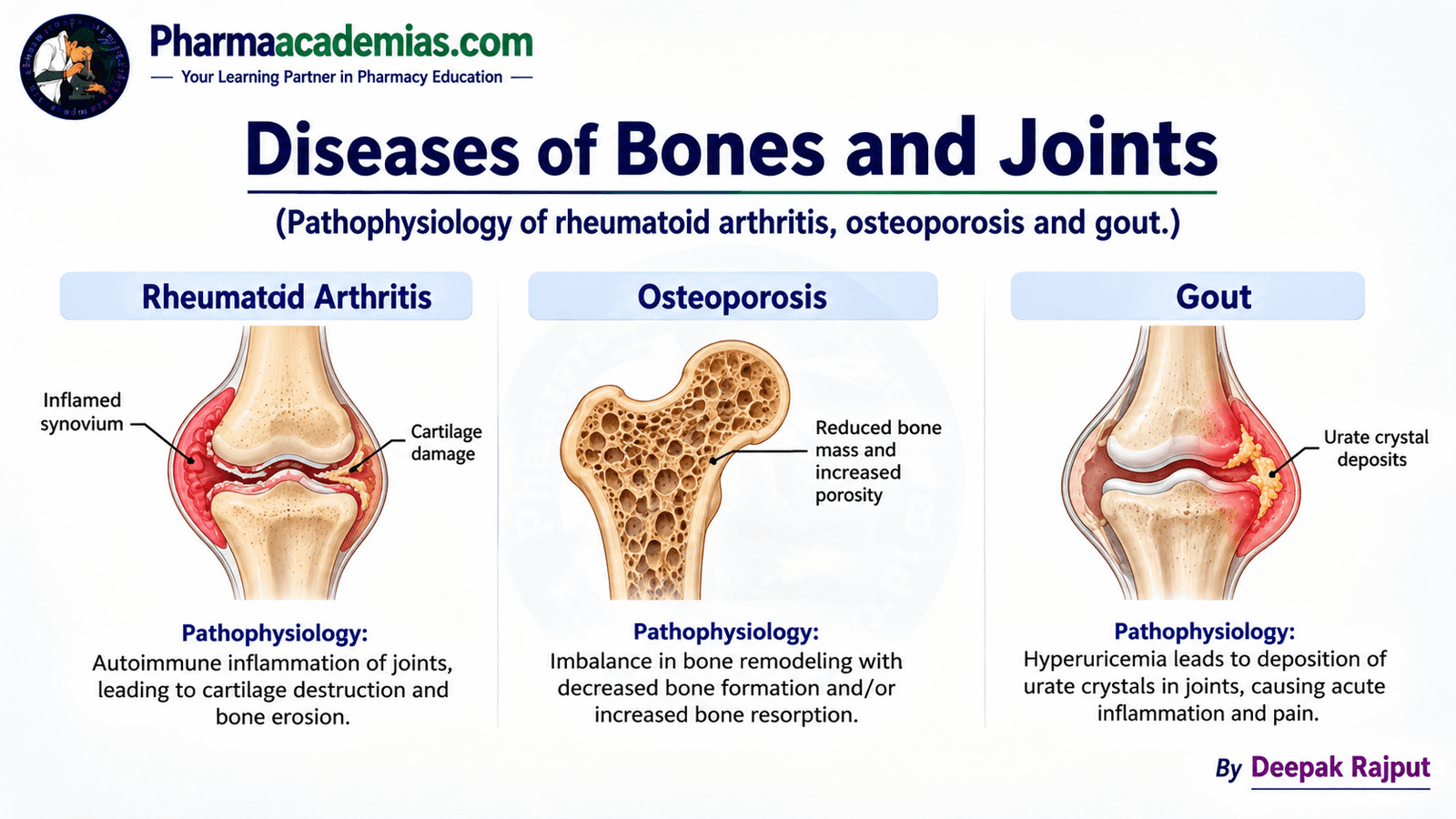 Diseases of Bones and Joints