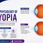 Pathophysiology of Myopia