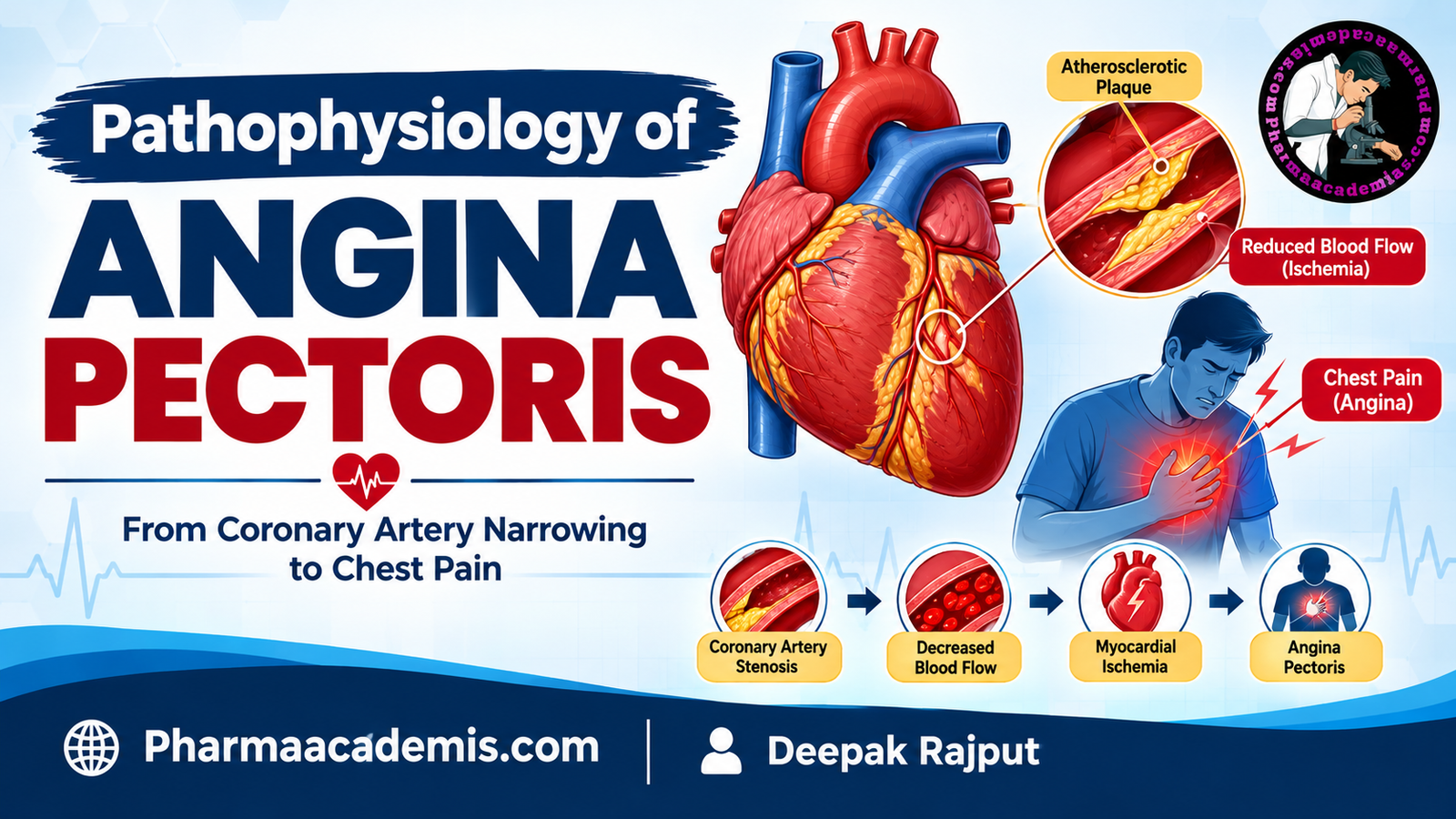 Pathophysiology of Angina Pectoris