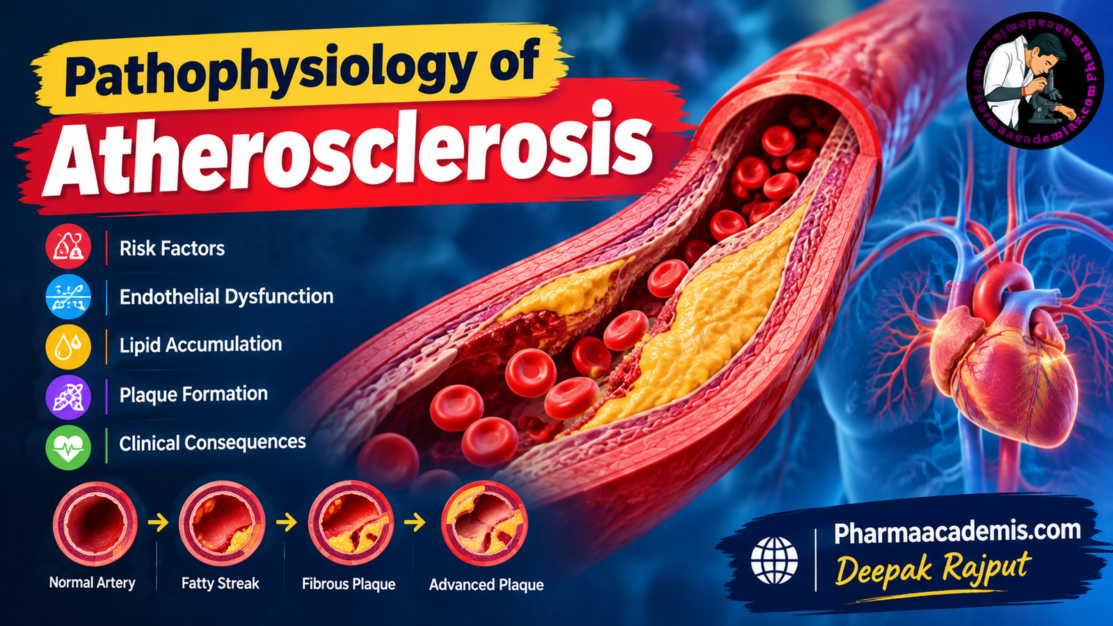 Pathophysiology of Atherosclerosis